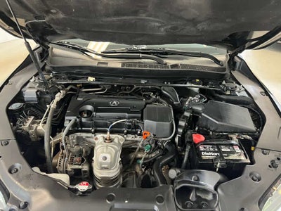 2015 Acura TLX 4dr Sdn FWD